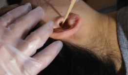 挖耳屎视频,趣味视频带你探索耳道清洁的奥秘